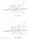 Fig. 17 - Apparatus and methods for treating obstructions within body lumens