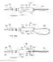 Fig. 22 - Apparatus and methods for treating obstructions within body lumens