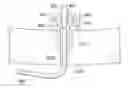 Fig. 01 - Device and method for percutaneous placement and anchoring of stimulating electrodes in spine
