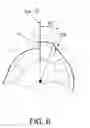 Fig. 09 - Arthroscopic devices and methods
