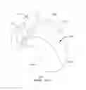 Fig. 02 - External tether airbag