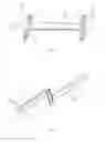 Fig. 02 - Lifting and carrying system for maintaining building facades