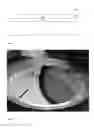 Fig. 02 - SYSTEMS AND METHODS FOR METAL LAYER ADHESION