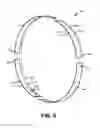 Fig. 09 - Flange heat shield