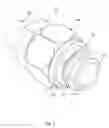 Fig. 02 - Threaded retainer