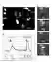 Fig. 18 - Method of using transmembrane channel-like protein 6 (TMC6) protein to identify substances affecting salty taste