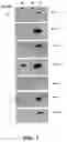 Fig. 02 - Dissolved protein arthritis markers