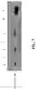 Fig. 08 - Dissolved protein arthritis markers