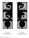 Fig. 09 - Touch-gesture control for side-looking sonar systems