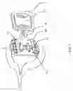 Fig. 09 - Helmet mounted display