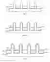 Fig. 04 - Fin field-effect transistor