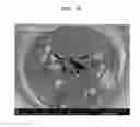 Fig. 06 - Negative active material, lithium secondary battery including the material, and method of manufacturing the material
