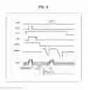 Fig. 10 - Solid-state imaging device and electronic device