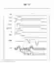 Fig. 14 - Solid-state imaging device and electronic device