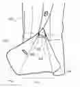 Fig. 01 - CLOTHING WITH ELASTIC CUFF CHANNEL