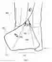 Fig. 02 - CLOTHING WITH ELASTIC CUFF CHANNEL