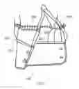 Fig. 03 - CLOTHING WITH ELASTIC CUFF CHANNEL