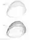 Fig. 11 - BRAIN-PROTECTING HELMET LINING APPARATUS AND METHOD