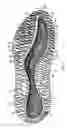 Fig. 04 - Sole structure for an article of footwear with first and second midsole bodies