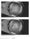 Fig. 10 - COSMETIC COMPOSITIONS WITH SENSORIAL AND AESTHETIC BENEFITS AND HAVING ENHANCED STABILITY