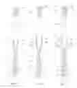 Fig. 05 - Method for producing a toothbrush, and toothbrush