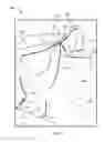 Fig. 02 - Interconnecting blanket assembly double layered sleeping system