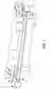 Fig. 02 - Room darkening curtain rods including removable finials