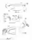 Fig. 05 - Cooking vessel with or without retainable cover and method of making the same