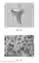 Fig. 06 - SPONGE FOR CLEANING DISH SURFACES AND METHOD OF MANUFACTURE