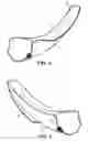 Fig. 04 - Guiding device for use with laryngoscope