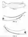 Fig. 05 - Guiding device for use with laryngoscope