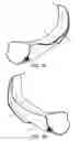 Fig. 08 - Guiding device for use with laryngoscope