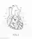 Fig. 03 - Medical image processing apparatus