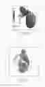 Fig. 06 - Medical image processing apparatus