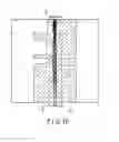 Fig. 10 - Medical image processing apparatus