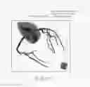 Fig. 11 - Medical image processing apparatus