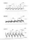 Fig. 10 - System and method for synchronizing external compression of a limb for increased blood