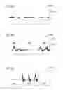 Fig. 11 - System and method for synchronizing external compression of a limb for increased blood