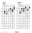 Fig. 03 - A Method and Device for Conducting a Self-Administered Hearing Test