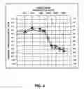 Fig. 04 - A Method and Device for Conducting a Self-Administered Hearing Test