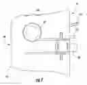 Fig. 08 - Biopsy actuator assembly