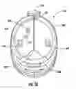 Fig. 17 - Biopsy actuator assembly
