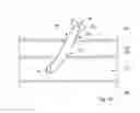 Fig. 05 - Device, Kit And Method For Closure Of A Body Lumen Puncture