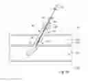 Fig. 06 - Device, Kit And Method For Closure Of A Body Lumen Puncture