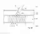 Fig. 16 - Device, Kit And Method For Closure Of A Body Lumen Puncture