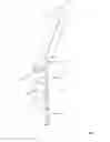 Fig. 04 - Method of using cannula for surgical procedure