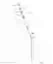 Fig. 09 - Method of using cannula for surgical procedure