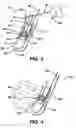 Fig. 03 - Surgical filament assemblies