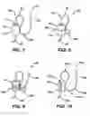 Fig. 05 - Surgical filament assemblies