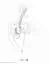 Fig. 09 - Suturing device for minimally invasive surgery and needles and methods thereof